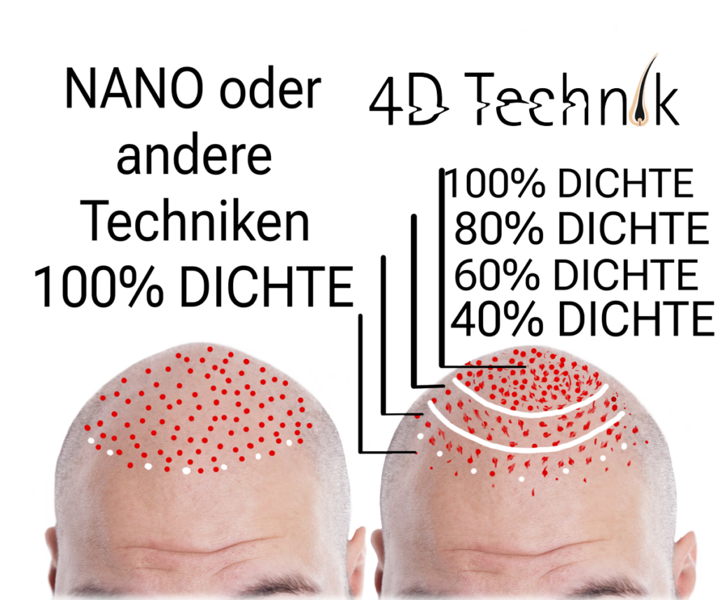 nano oder 4d-haarpigmentierung unterschied