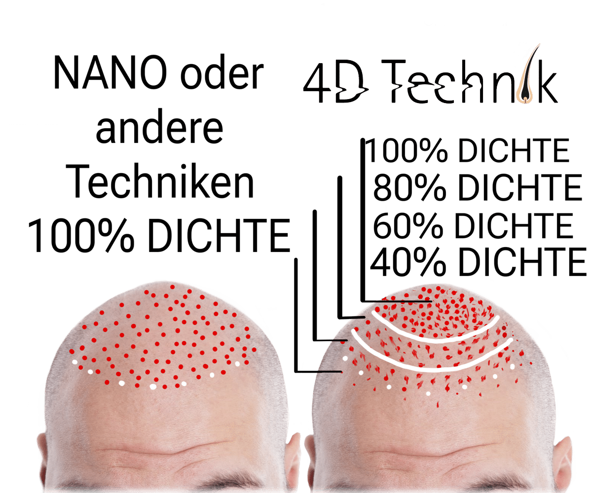 nano oder 4d-haarpigmentierung unterschied